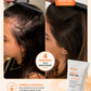 Serum Capilar Intensivo PDRN Anticaída