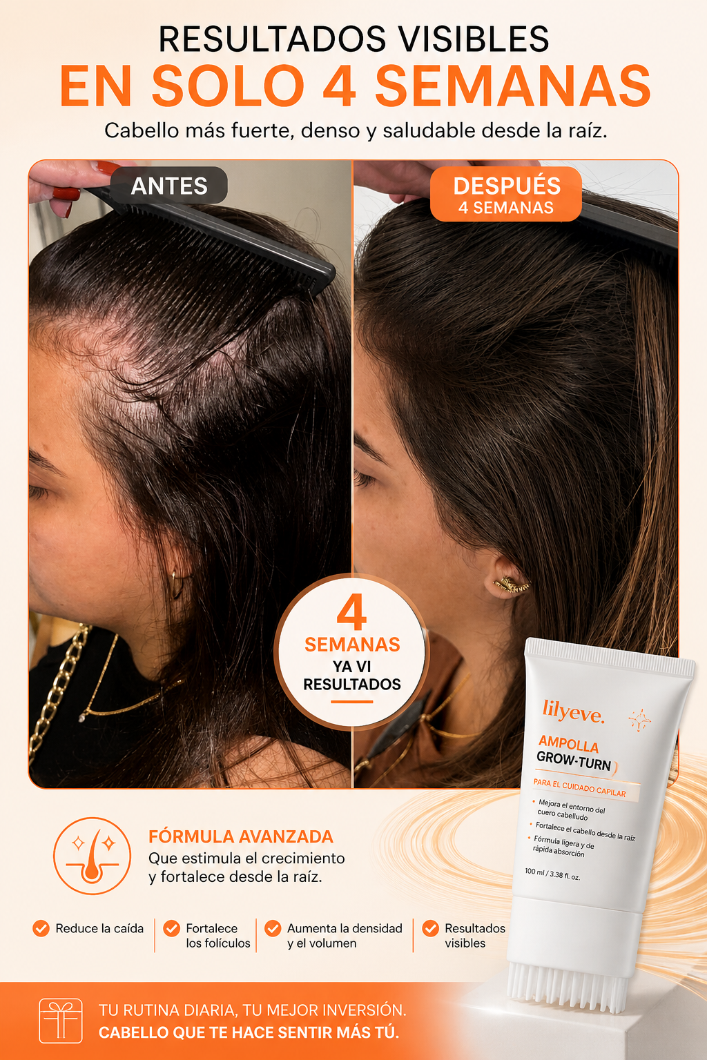 Serum Capilar Intensivo PDRN Anticaída