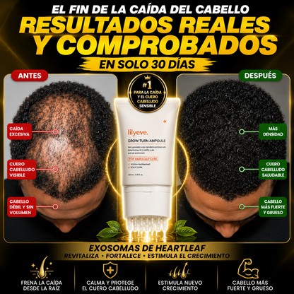Serum Capilar Intensivo PDRN Anticaída